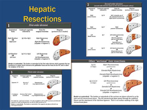 Liver Resections Cape Town Hepato Pancreato Biliary Surgery