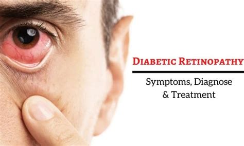 Diabetic Retinopathy Symptoms And Treatments
