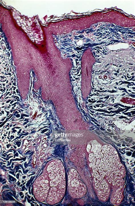 Skin Sebaceous Glands And Hair Follicle Human Scalp 25x At 35mm Shows