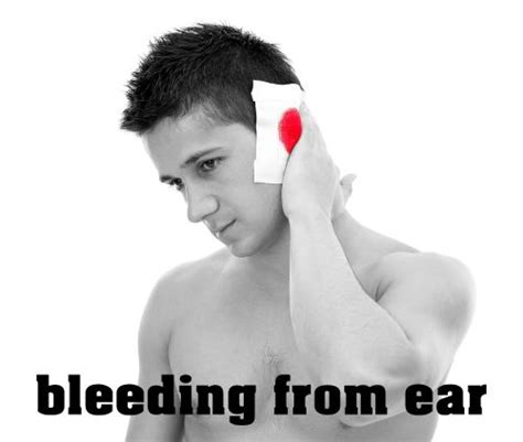 Bleeding From Ear Everything That You Need To Know