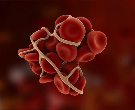 Read 1,137 reviews from the world's largest community for readers. What Everyone Should Know About Blood Clots - Health ...