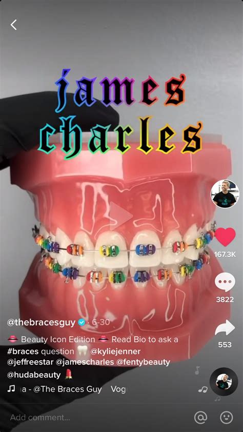 √ Braces Colors Chart