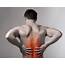 Your Guide To Different Types Of Back Pain