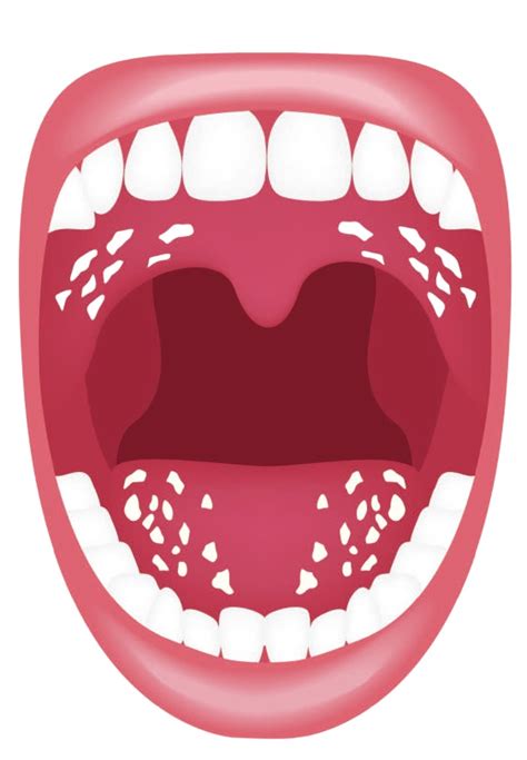 جفاف الفم الأعراض والأسباب والعلاج