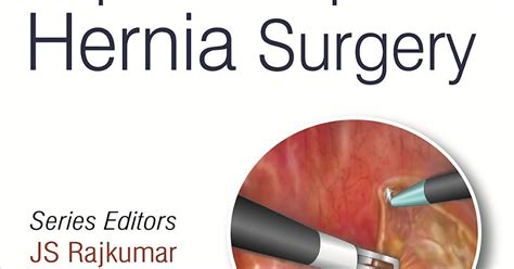 Laparoscopic Hernia Surgery Vol 4 Step By Step Manual Of