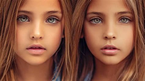 most beautiful twins in the world then and now 2024