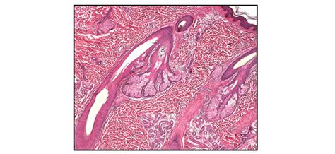 Pilo Sebaceous Units