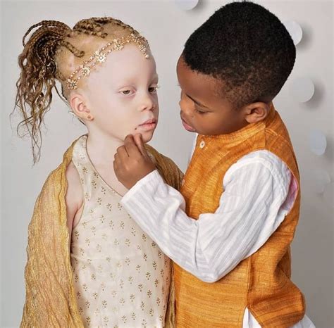 Twins With Different Skin Colors Astonished Their Mom When They Were Born Keep On Mind