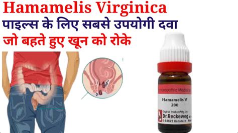 Hamamelis Homeopathic Medicine Hamamelis 200 Bavasir Ke Liye Best Dava