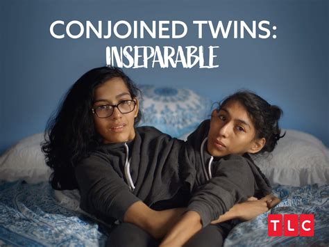 Watch Conjoined Twins Inseparable Special Prime Video