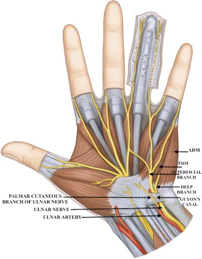 Ulnar Tunnel Syndrome Musculoskeletal Key