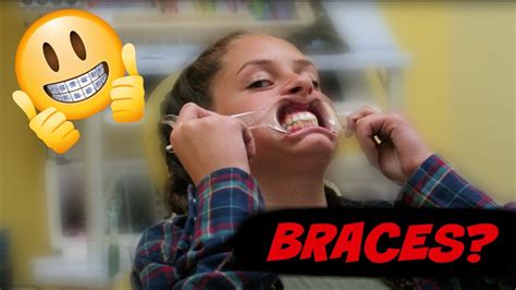 How To Know If We Need Braces How To Determine If You Need Braces With Pictures Wikihow