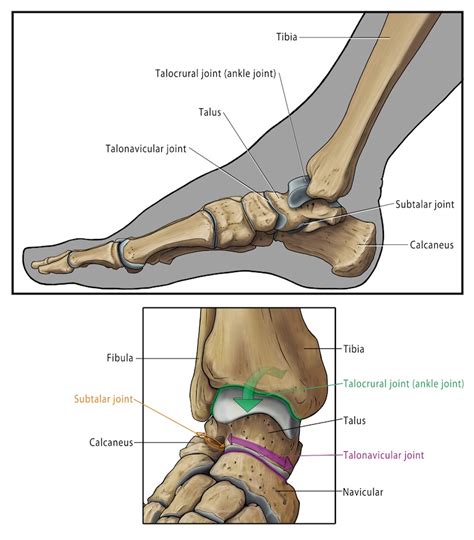 Ankle Arthritis — Ankle Arthritis Ankle Replacement