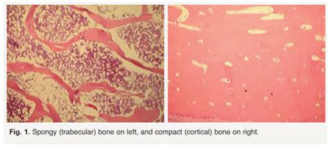 Histology Of Spongy Bone