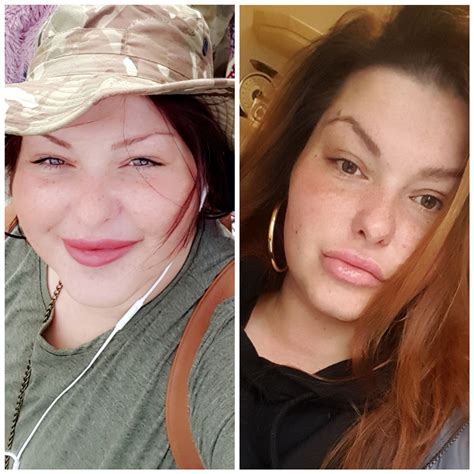 Three Months Apart Face Gains If And Mild Exercise Rintermittentfasting