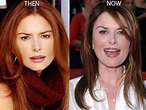 Roma Downey Plastic Surgery Before And After Photos - CelebLens.Com