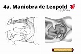 Maniobras de Leopold