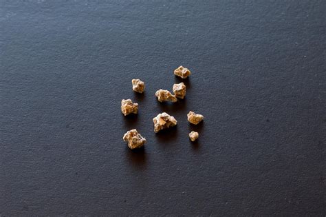 Pictures Of Different Types Of Kidney Stones