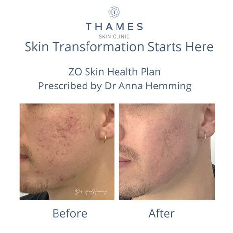 Zo Skin Health Browse And Reorder Zo Products Thames Skin Clinic