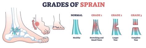 Sprains Strains And Automobiles Element Chiropractic