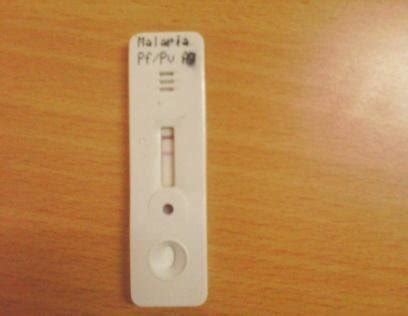 You work in primary care (for example a gp, pharmacist. Showing Accucare Malaria Antigen Test, positive for P ...