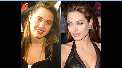 Angelina Jolie Nose Job Angelina Jolie Plastic Surgery Celebrities