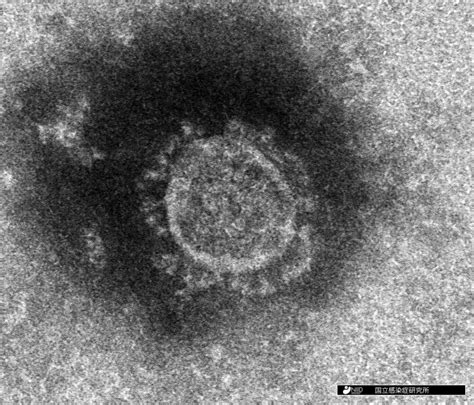 新型コロナウイルス：国立感染症研究所が開発した細胞で分離に成功