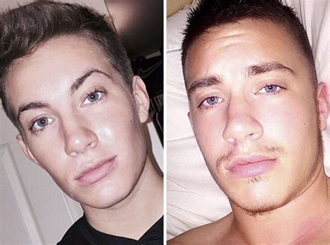 Transgender Man Shares Incredible Before After Progress Photos Sexiz Pix