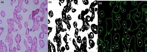 Analysis Of Placental Villi By ImageJ Software A Normal Appearance Download Scientific