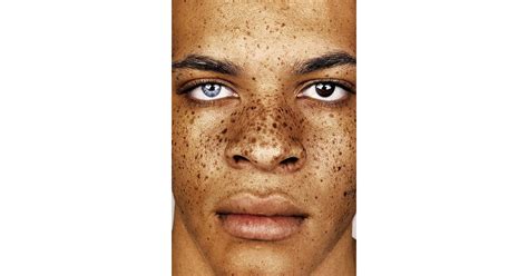 Photos Of People With Freckles Popsugar Beauty Photo 7