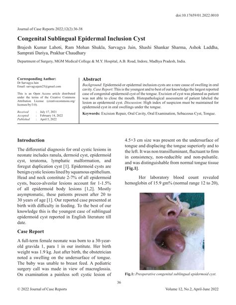 Pdf Congenital Sublingual Epidermal Inclusion Cyst