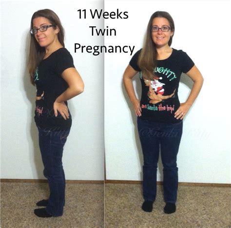 Week 11 Vegan Twin Pregnancy Update Genki Kittys Blog