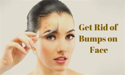 Bumps On Face Natural Remedies To Treat Naturally