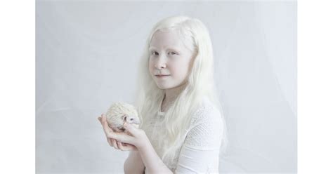 Yulia Taitss Porcelain Beauty Series Albinism Photographs Yulia