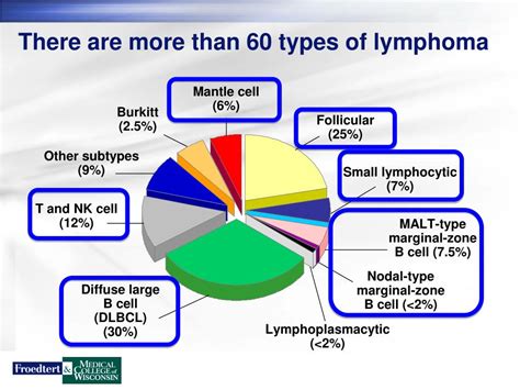 It is rare in the united states, and much. PPT - Lymphoma Overview PowerPoint Presentation, free ...
