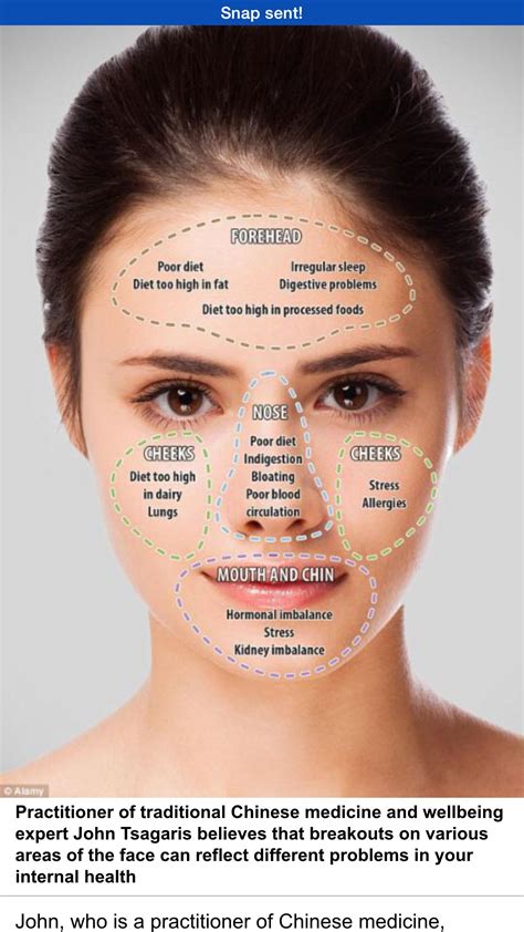 So True Face Acne Acne Skin Skin Care Acne Skin Care Tips Jawline