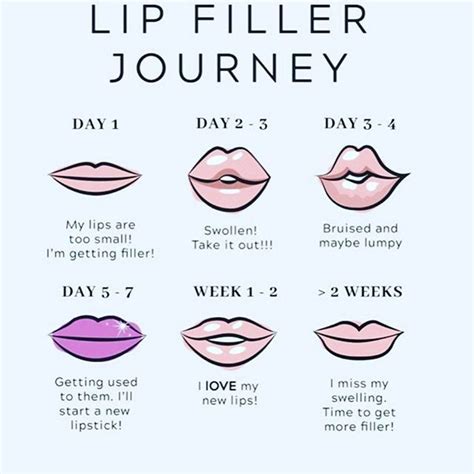 Your Lip Filler Journey Lip Fillers Botox Fillers Cosmetic Fillers