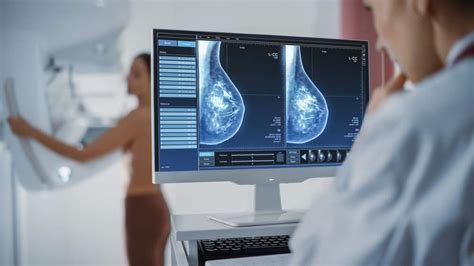 Mamografia Como é Feito O Exame E Quem Deve Realizá Lo Vitat