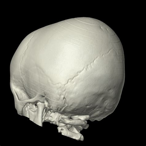 Absence Of The Sagittal Suture Normal Skull Configuration Image