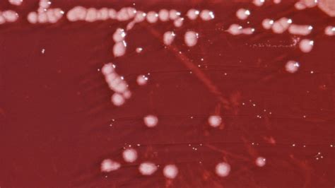 Pseudomona Aeruginosa Una Bacteria Cada Vez Más Poderosa Ondas Y