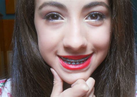 Braces And Lipstick Adult Braces Braces Girls Metal Braces Make Up