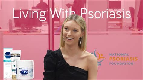 Living With Psoriasis Youtube