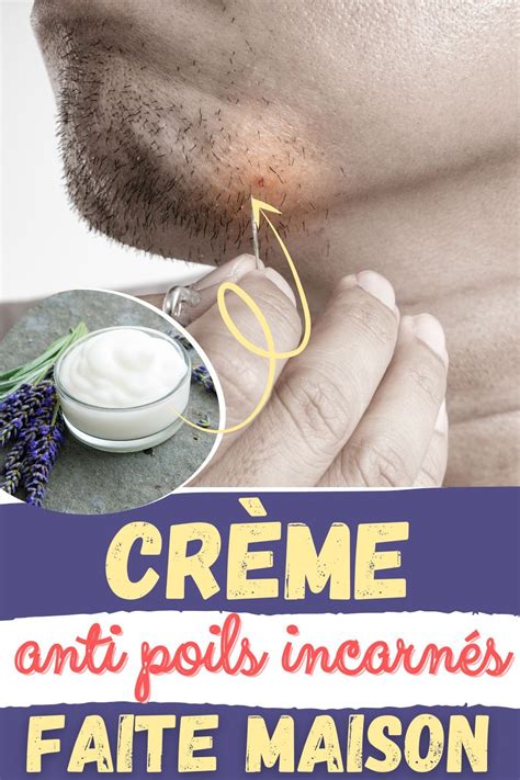 Crème Anti Poils Incarnés Faite Maison Poil Incarné Creme Poils