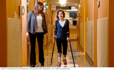Spina Bifida Care At Mayo Clinic