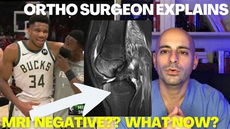 🏀Giannis Knee MRI Update!!- Absolutely MIND BLOWING! But Don’t