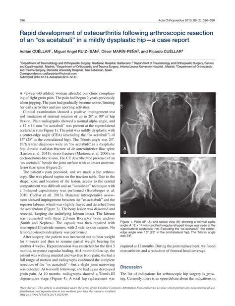 Pdf Rapid Development Of Osteoarthritis Following Arthroscopic