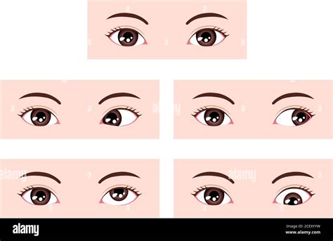 Types Of Strabismus Vector Illustration Stock Vector Image And Art Alamy