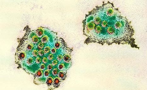 Under a microscope, intestinal cells infected by norovirus have an intact mucosa and epithelium, but there are a lot of lymphocytes in the lamina propria layer of the mucosa. A nasal spray for norovirus: New drug reduces chance of ...