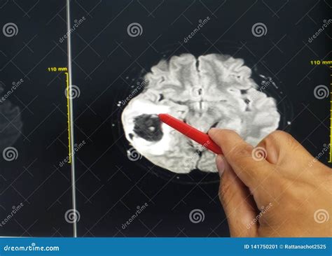 Examination Of The Brain With Mri Doctor In Emergency Order Scans