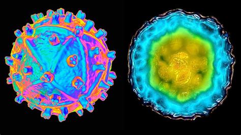 links between hiv and hepatitis c infection everyday health